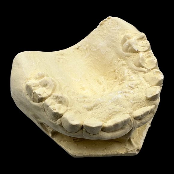 Vintage Plaster Dental Mold - Teeth Tooth Mold - Creepy Oddity - Dental Oddities - Picture 11 of 16